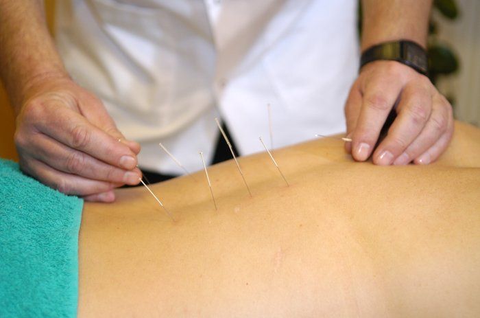 Baza zabiegowa akupunktura Centrum Rehabilitacji Czerniawa